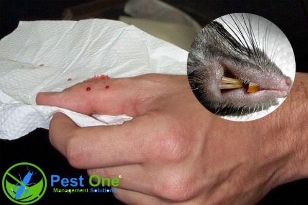 Một số triệu chứng và biểu hiện của bệnh sốt Haverhill