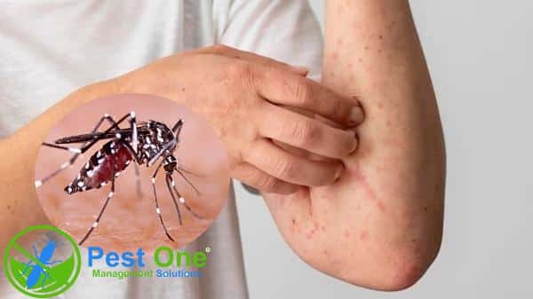 Nguy cơ từ các loại côn trùng nhỏ trong nhà