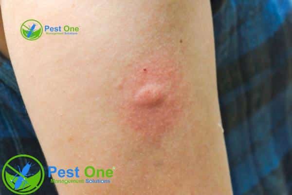 Tác hại của mối đến sức khỏe