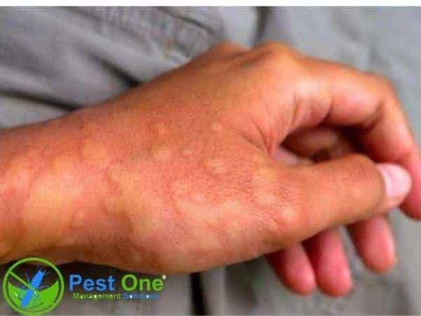 Thuốc diệt côn trùng ảnh hưởng đến sức khỏe lâu dài