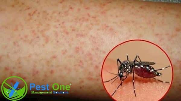 Muỗi là trung gian truyền nhiễm của nhiều loại virus và ký sinh trùng gây bệnh