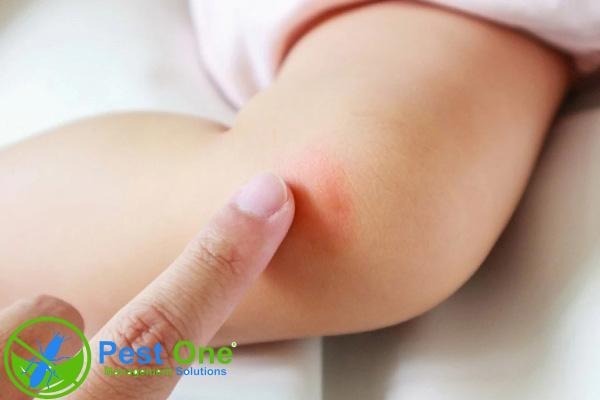 Nhiều loài côn trùng là trung gian truyền bệnh như muỗi